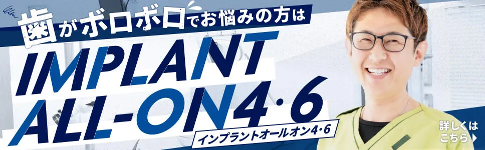 歯がボロボロでお悩みの方はインプラントオールオン4・6
